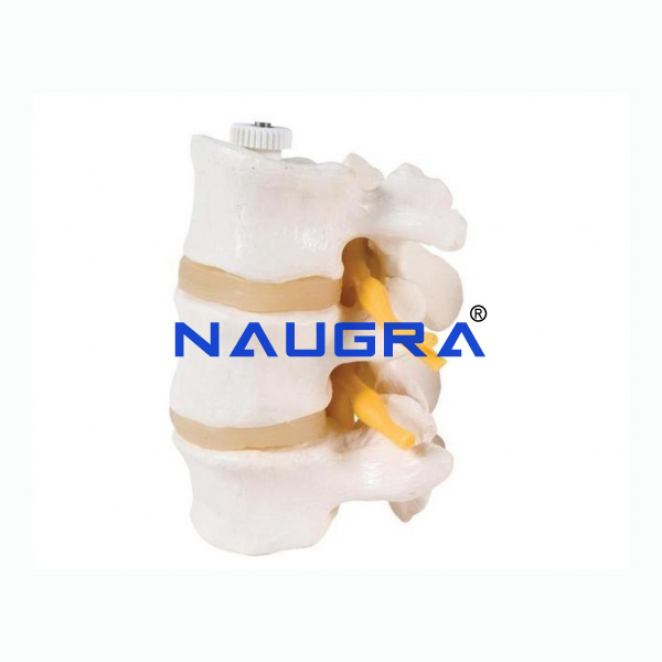 2 Lumbar Vertebrae/ 3 Lumbar Vertebrae - TVET Lab Equipment Manufacturer India