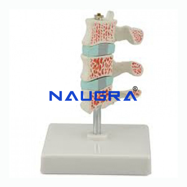 Advanced Osteoporosis Model - TVET Lab Equipment Manufacturer India